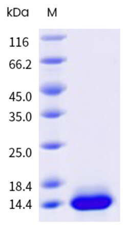 Sino Biological&nbsp;Recombinant Human Apolipoprotein H Protein (Domain V, His Tag), Low Endotoxin, HPLC-verified 1