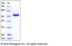 Sino Biological Recombinant Human Chitotriosidase/CHIT1 Protein (His Tag),