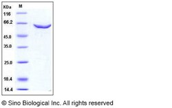 Sino Biological Recombinant Human DNMT2 Protein (GST Tag), Quantity: Each