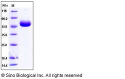 Sino Biological SARS-CoV-2 (2019-nCoV) Nucleocapsid(R203K, G204R)-His Recombinant