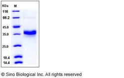 Sino Biological Human FOLR1 / Folate receptor alpha Protein (ECD,His Tag)