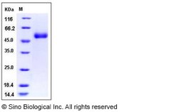 Sino Biological Recombinant Human ACPL2 Protein (His Tag), Quantity: Each