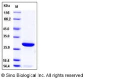 Sino Biological Human Peroxiredoxin 6 / PRDX6 Protein (His Tag) 100ug,