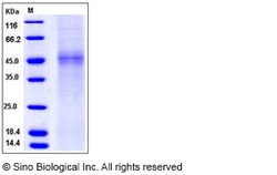 Sino Biological Recombinant Human TPST1 Protein (His Tag), Quantity: Each