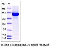 Sino Biological Recombinant Human ACOX1 Protein (His Tag), Quantity: Each