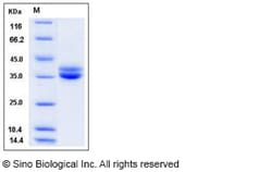 Sino Biological Recombinant Human GPA33/A33 Protein (His Tag), Quantity: