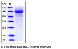 Sino Biological Recombinant Human CD97 Protein (His Tag), Quantity: Each