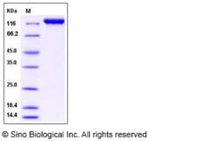 Sino Biological Recombinant Human IGSF3 Protein (His Tag), Quantity: Each