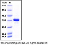 Sino Biological Recombinant Human AKR1B1 Protein (His Tag), HPLC-verified,