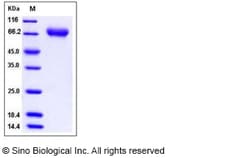 Sino Biological Recombinant Human FLRT2 Protein (His Tag), Quantity: Each