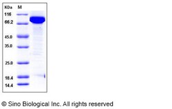 Sino Biological Recombinant Human EED Protein (His & GST Tag), Quantity: