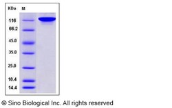 Sino Biological Recombinant Human Autotaxin/ENPP-2 Protein (His Tag), HPLC-verified,