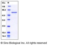 Sino Biological Recombinant Human RbAp48 Protein (His Tag), Quantity: Each