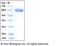 Sino Biological Recombinant Human EphA4 Protein (His Tag), HPLC-verified