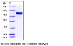 Sino Biological Recombinant Human FUT8 Protein (aa 68-575, His Tag), HPLC-verified,