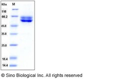 Sino Biological Human FUT10 / Fucosyltransferase 10 Protein (His Tag) 100ug,