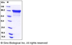 Sino Biological Recombinant Human HSC70 Protein (His Tag), Quantity: Each