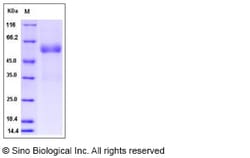 Sino Biological Recombinant Human FAM3B Protein (hFc Tag), Quantity: Each