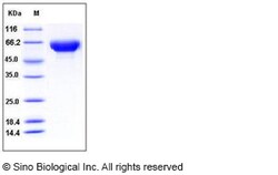 Sino Biological Human ORP150 / HYOU1 / HSP12A Protein (His Tag) 50ug, Quantity: