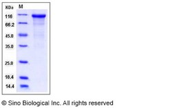 Sino Biological Recombinant Human Cadherin-17 Protein (His Tag), HPLC-verified,