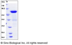 Sino Biological Human BIN1 / Amphiphysin-II Protein (His Tag) 100ug, Quantity:
