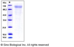 Sino Biological Recombinant Human RP105/CD180 Protein (His Tag), Quantity: