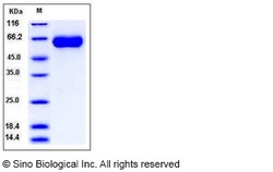Sino Biological Human MGAT5 / GGNT5 Protein (His Tag) 50ug, Quantity: Each