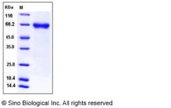Sino Biological Recombinant Human FLRT1 Protein (His Tag), Quantity: Each