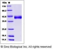 Sino Biological Recombinant Human CHST11 Protein (His Tag), Quantity: Each
