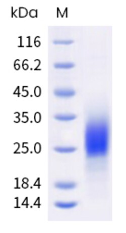Sino Biological Human CHST9 Protein 100ug (Sino Biological), Quantity: