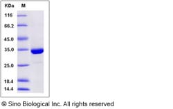 Sino Biological Human SULT1A3 Protein (His Tag) 50ug, Quantity: Each of