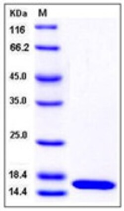Sino Biological Recombinant Human PMP2 Protein (His Tag), Quantity: Each