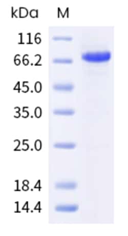 Sino Biological Human SDC1 Protein 100ug (Sino Biological), Quantity: Each