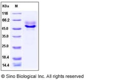 Sino Biological Human Syndecan-1 / SDC1 / CD138 Protein (ECD, His Tag)
