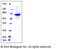 Sino Biological Recombinant Human Pyruvate kinase PKM Protein (Isoform