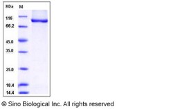 Sino Biological Human AGO3 / Argonaute 3 / EIF2C3 Protein (His Tag) 20ug,
