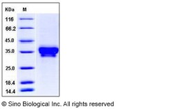 Sino Biological Human STIM1 / GOK Protein (His Tag) 100ug, Quantity: Each