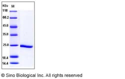 Sino Biological Recombinant Human HSP90-alpha / HSP90AA1 Protein, HPLC-verified