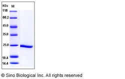 Sino Biological Recombinant Human HSP90-alpha / HSP90AA1 Protein, HPLC-verified,
