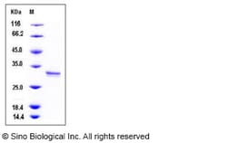 Sino Biological Recombinant Human CUTC Protein (His Tag), Quantity: Each