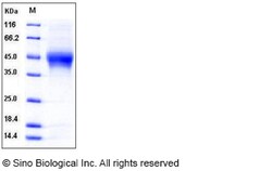 Sino Biological Recombinant Human IL-21 Receptor/IL-21R Protein (His Tag),