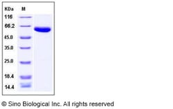 Sino Biological Human Carboxypeptidase B2 / CPB2 Protein (His Tag) 100ug,