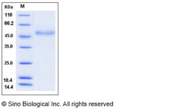 Sino Biological Recombinant Human Factor VII Protein (His Tag), HPLC-verified,