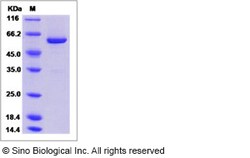 Sino Biological Recombinant Human PTPN9 Protein (His & GST Tag), Quantity: