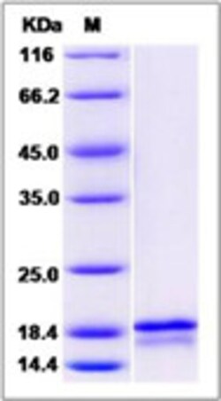 Sino Biological Recombinant Human FGF6 Protein, Quantity: Each of 1