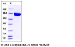 Sino Biological Recombinant Human PAK3 Protein (His Tag), Quantity: Each