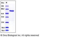 Sino Biological Recombinant Human NEK7 Protein (His & GST Tag), Quantity: