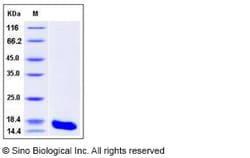 Sino Biological Recombinant Human Cystatin S Protein (His Tag), HPLC-verified,