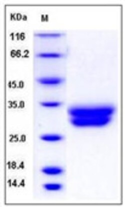 Sino Biological Human VSIG2 / CTXL Protein (His Tag) 100ug, Quantity: Each