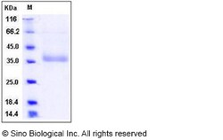 Sino Biological Human NCR2 / NKp44 / CD336 Protein (His Tag) 100ug, Quantity:
